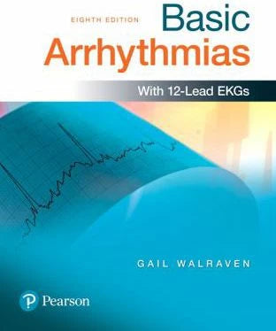 Basic Arrhythmias